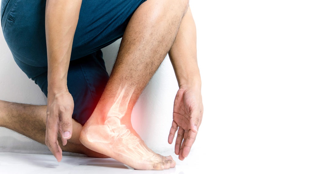 leg pain chiropractic treatment - Resilience Chiropractic